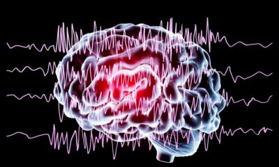 Studio su CBD ed epilessia