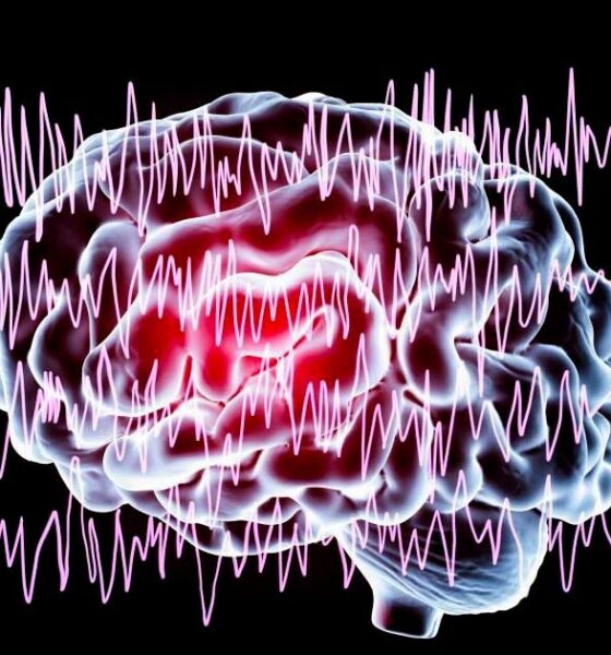 Studio su CBD ed epilessia