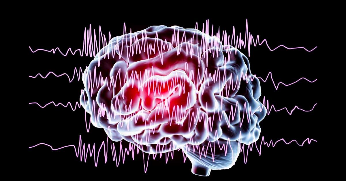 Studio su CBD ed epilessia
