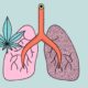 Studio sull'effetto della cannabis e del tabacco sui polmoni