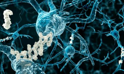 CBD per la memoria e l'Alzheimer