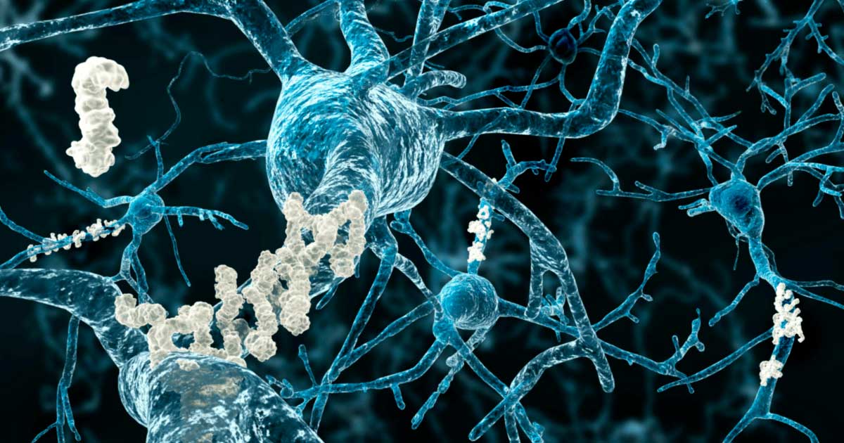 CBD per la memoria e l'Alzheimer