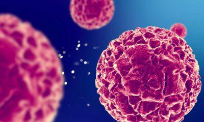 Azione antitumorale del CBD