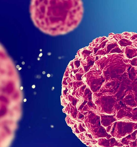 Azione antitumorale del CBD