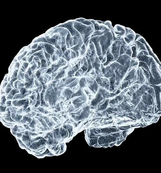 CBN e Alzheimer