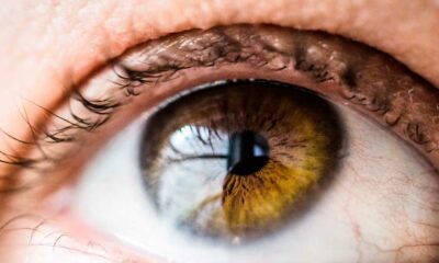 Il CBD e il trattamento dell'infiammazione oculare